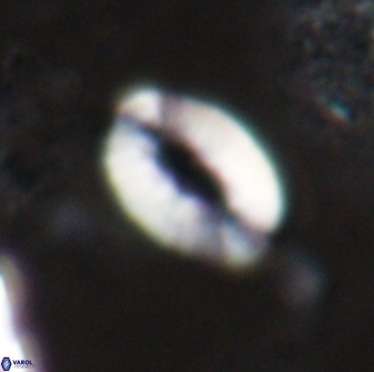 Neocrepidolithus triforaminatus 25613