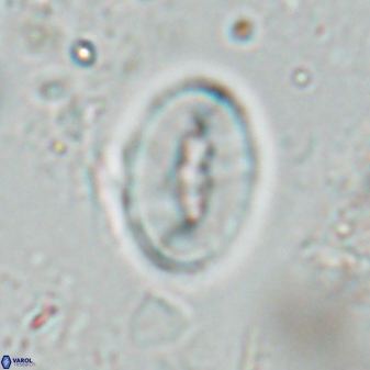 Neocrepidolithus triforaminatus 25620