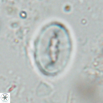 Neocrepidolithus triforaminatus 25620