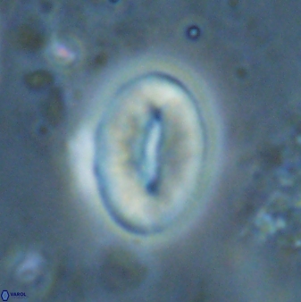 Neocrepidolithus triforaminatus 25622