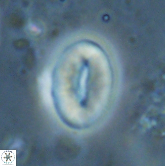 Neocrepidolithus triforaminatus 25622