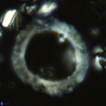 Neosphaera coccolithomorpha VR 03888