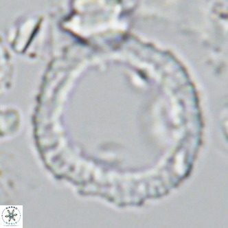 Neosphaera coccolithomorpha VR 03891