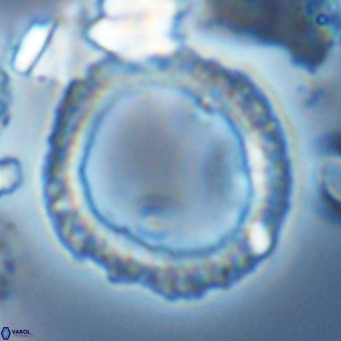 Neosphaera coccolithomorpha VR 03892