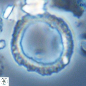Neosphaera coccolithomorpha VR 03892
