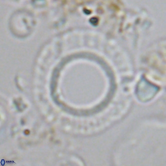 Neosphaera coccolithomorpha VR 03908