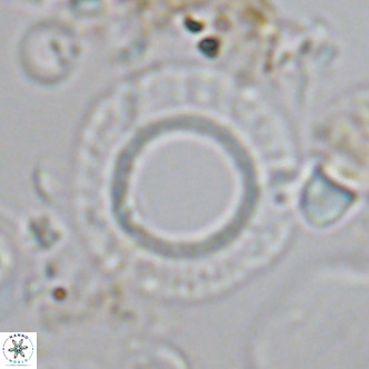 Neosphaera coccolithomorpha VR 03908