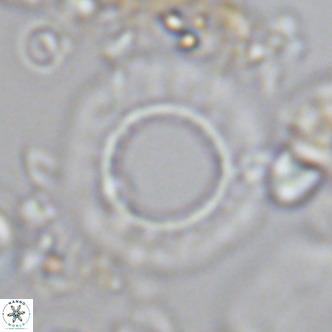 Neosphaera coccolithomorpha VR 03909