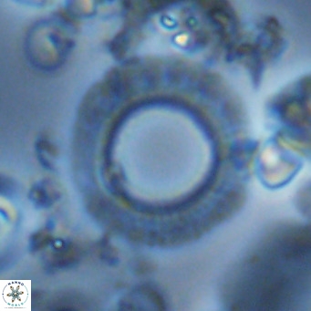 Neosphaera coccolithomorpha VR 03912