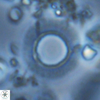 Neosphaera coccolithomorpha VR 03913