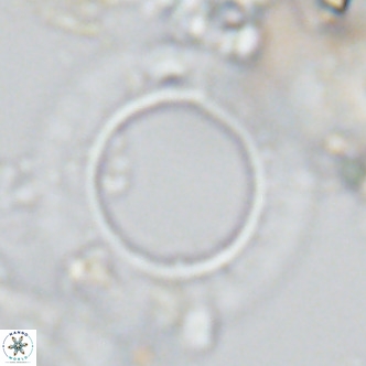 Neosphaera coccolithomorpha VR 03921