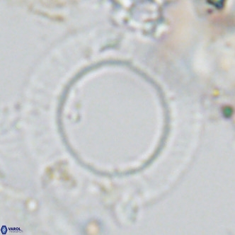 Neosphaera coccolithomorpha VR 03922