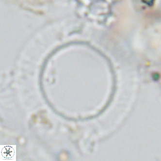 Neosphaera coccolithomorpha VR 03922