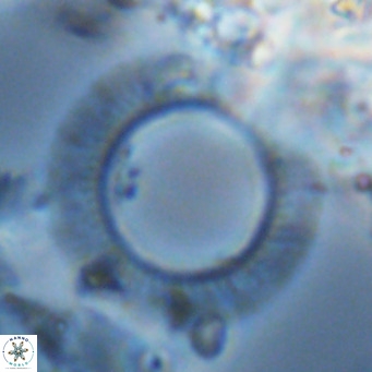 Neosphaera coccolithomorpha VR 03923