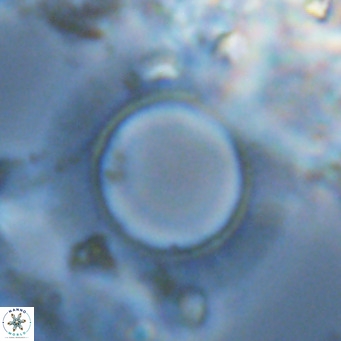 Neosphaera coccolithomorpha VR 03924