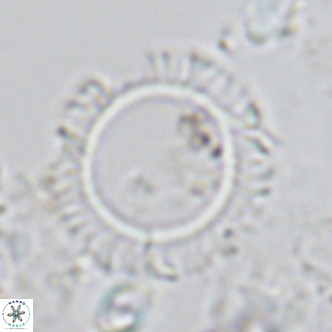 Neosphaera coccolithomorpha VR 05126