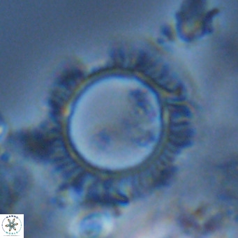 Neosphaera coccolithomorpha VR 05127