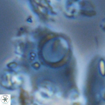 Neosphaera coccolithophorpha VR 05322