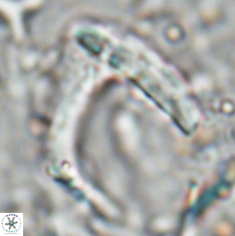 Nicklithus amplificus 26312