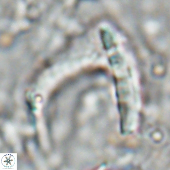 Nicklithus amplificus 26313