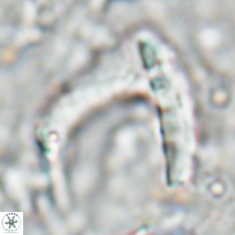 Nicklithus amplificus 26314