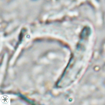 Nicklithus amplificus 26315