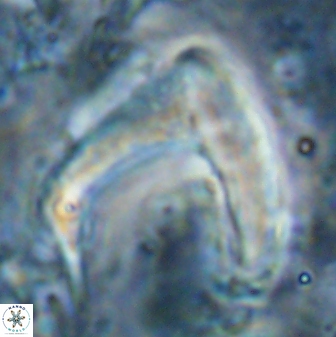 Nicklithus amplificus 26316