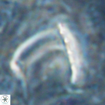 Nicklithus amplificus 26317