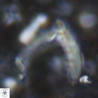 Nicklithus amplificus 26318