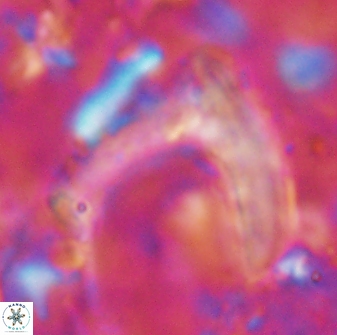 Nicklithus amplificus 26320