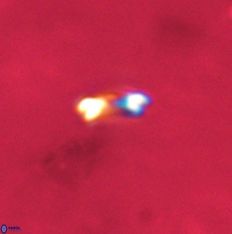 Noelaerhabdus bekei VR 02304