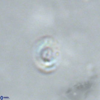 Noelaerhabdus bekei VR 02326