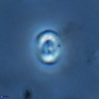 Noelaerhabdus bekei VR 02330