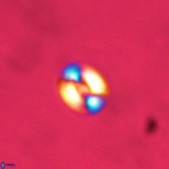 Noelaerhabdus bekei VR 02354