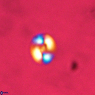 Noelaerhabdus bekei VR 02355