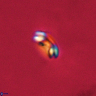 Noelaerhabdus bekei VR 02369