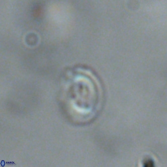 Noelaerhabdus bekei VR 02360