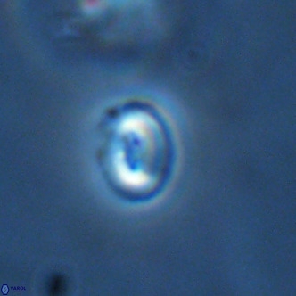 Noelaerhabdus bekei VR 02361