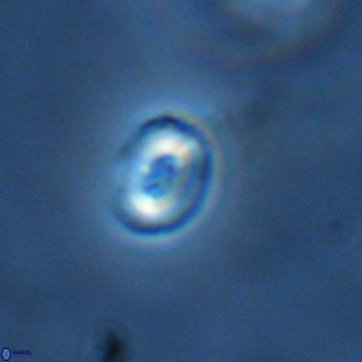 Noelaerhabdus bekei VR 02362