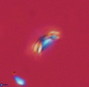 Noelaerhabdus bekei VR 03175