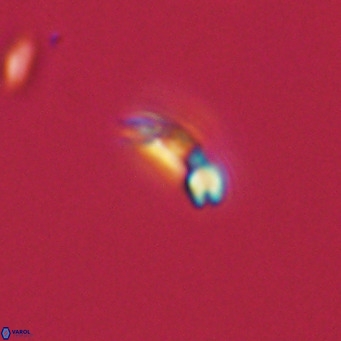 Noelaerhabdus bekei VR 03181