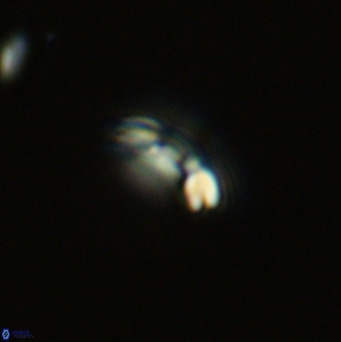 Noelaerhabdus bekei VR 03182