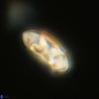 Noelia plevrrotos VR 07083