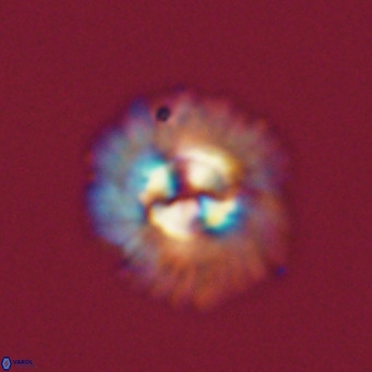 Noelia plevrrotos VR 07095