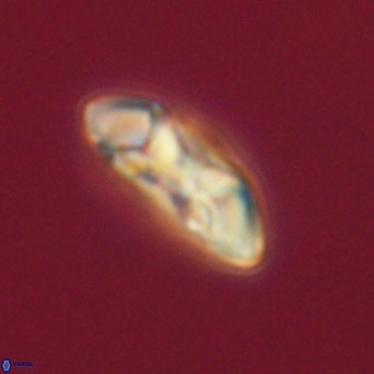 Noelia plevrrotos VR 07108