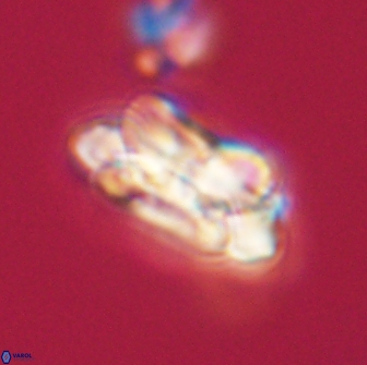 Noelia unverdii 64690