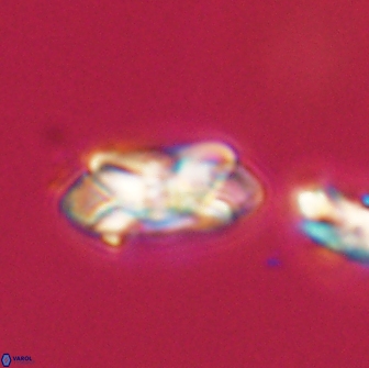 Noelia unverdii 64858