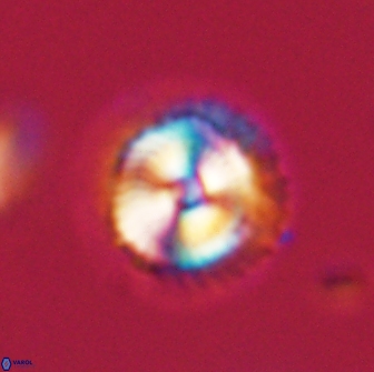 Noelia unverdii 64870