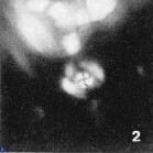 Isocrystallithus partitum 7618