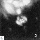 Isocrystallithus partitum 7618
